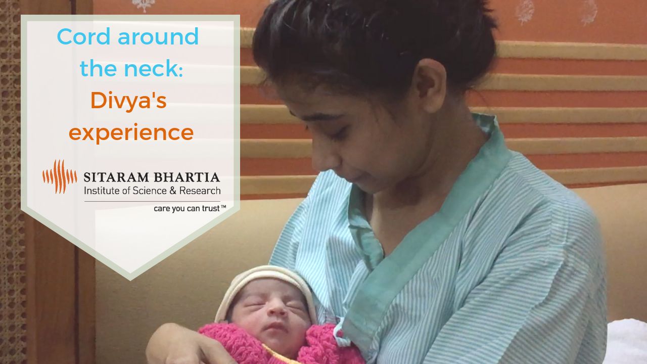 Cord Around the Neck Is Normal Delivery Possible?