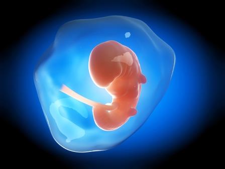 causes low amniotic fluid causes low amniotic fluid