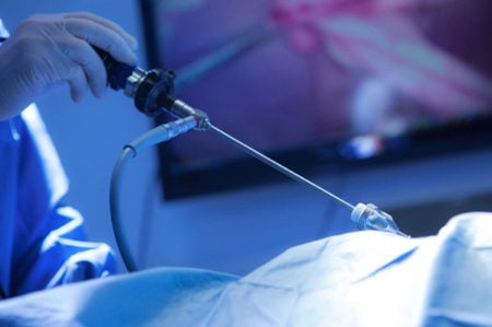 Laparoscopic Hernia Repair