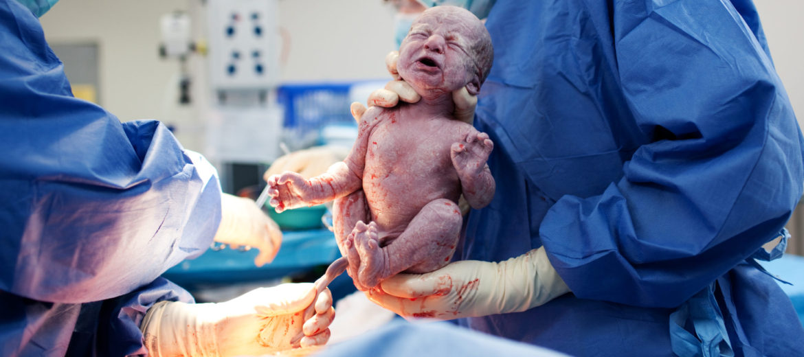 cesarean risks, cesarean planning