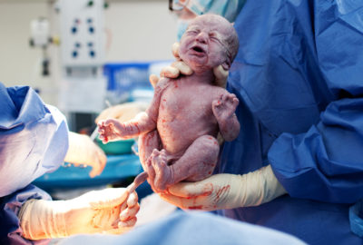 cesarean risks, cesarean planning