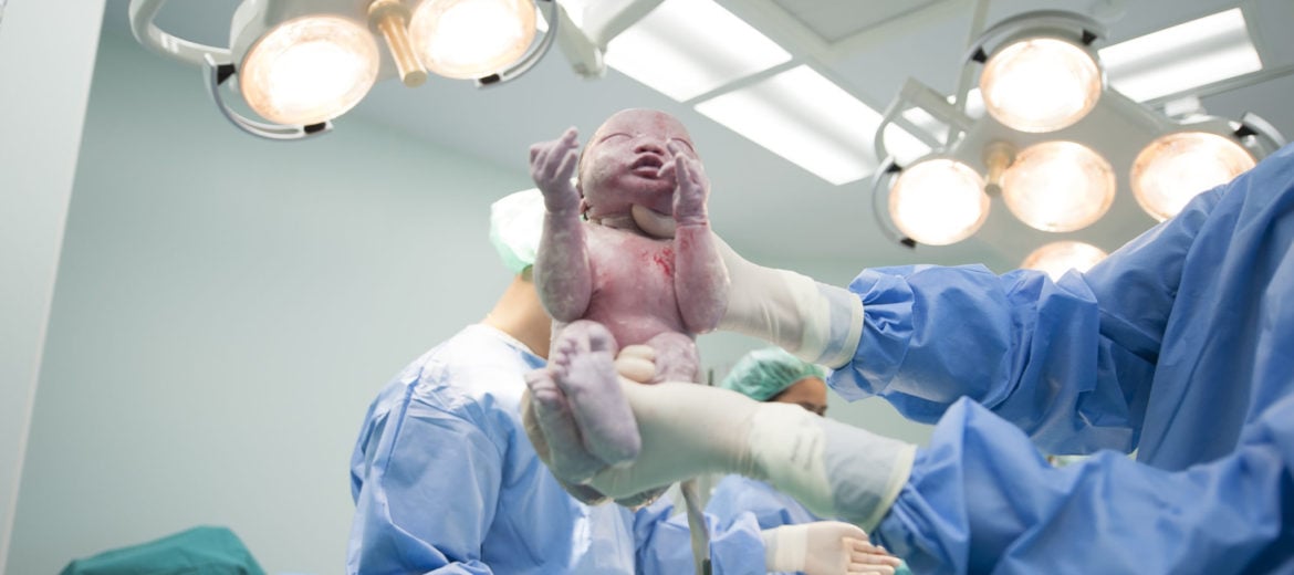 cesarean, cesarean risks, cesarean surgery