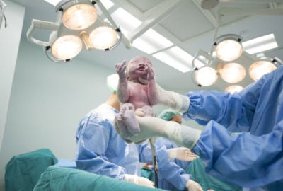 cesarean, cesarean risks, cesarean surgery