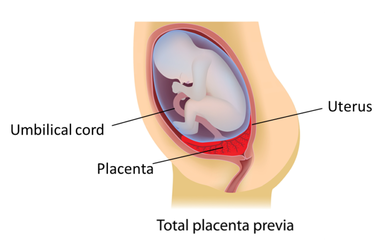 asian-placenta-previa-orgasm-sister