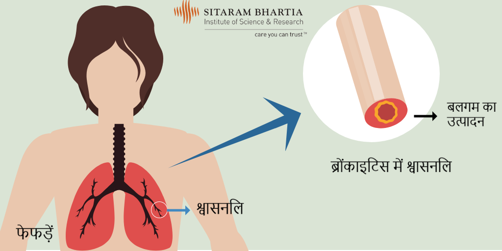 bronchitis symptoms in hindi