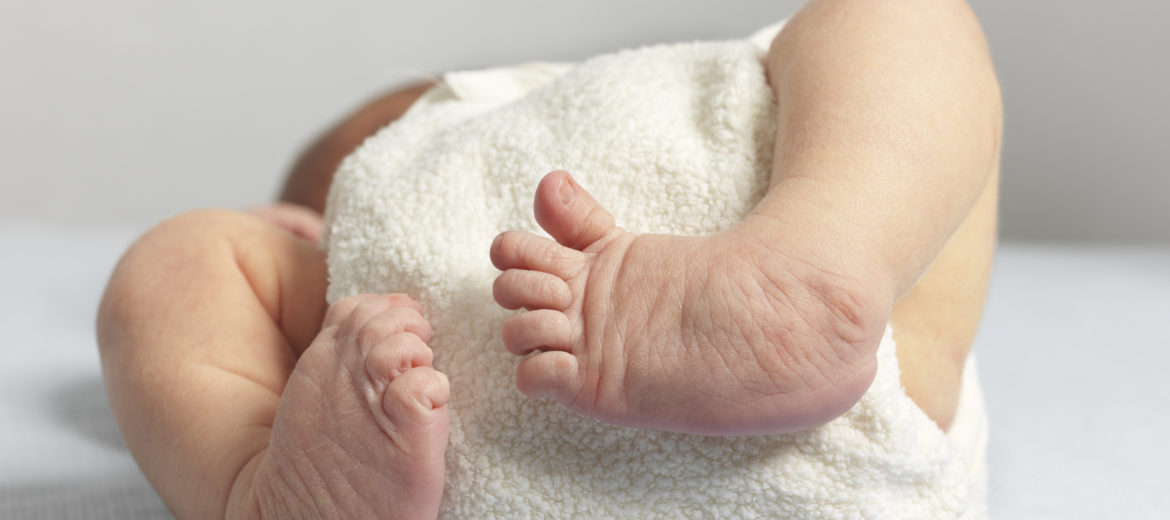 CTEV – Why Clubfoot Should Be Treated Early