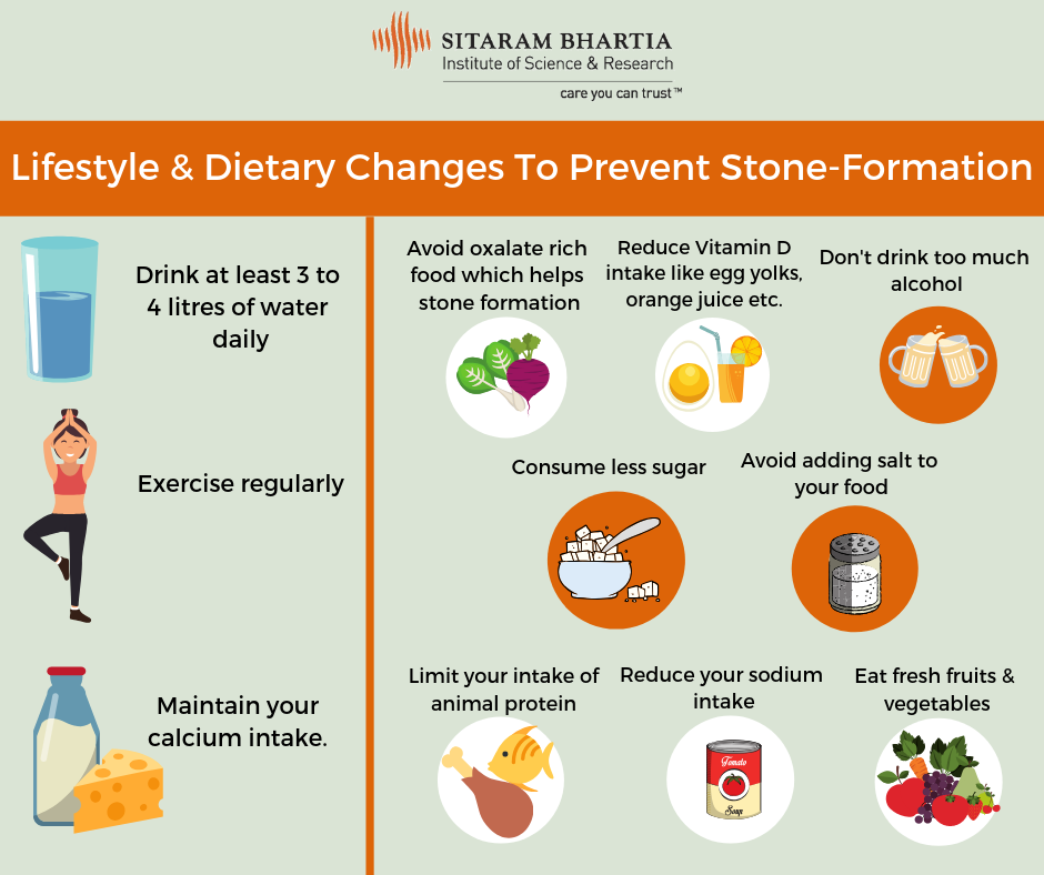 Kidney Stone Patient Food Chart