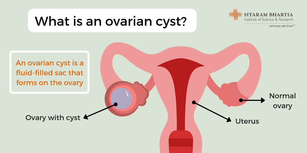 how big is an ovary