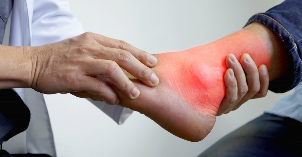 Uric Acid In Hindi – यूरिक एसिड बढ़ने से हो सकती है ये दो बीमारियाँ