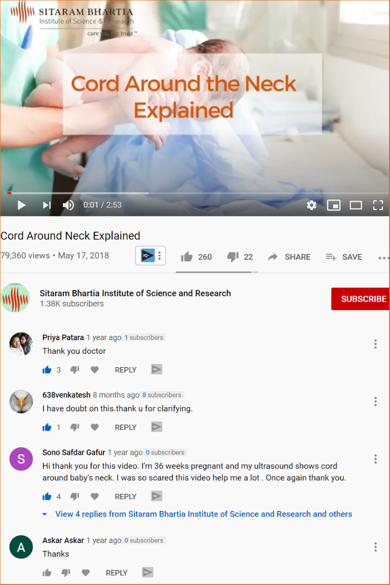 How to Remove Cord around Baby's Neck Pictures, Videos and Success