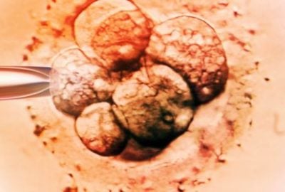 frozen-embryo-transfer-ivf-sitarambhartia