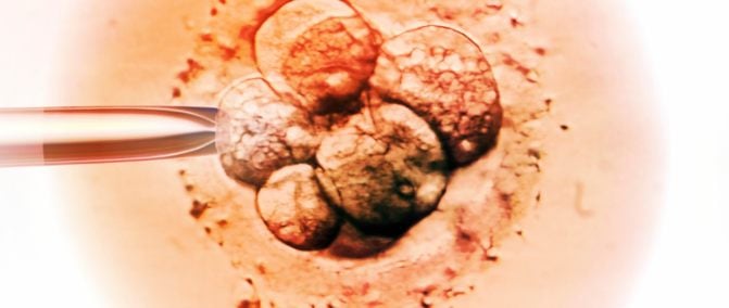 frozen-embryo-transfer-ivf-sitarambhartia