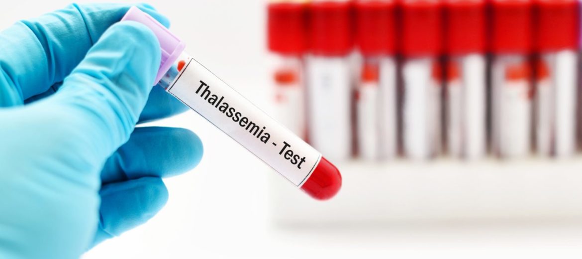 Thalassemia in Pregnancy: Tests, Types and Tips