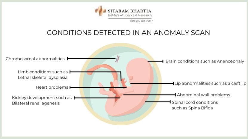 some conditions detected in anomaly scan