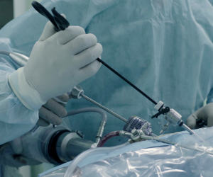 Laparoscopy for Infertility: Procedure, Recovery & Pregnancy